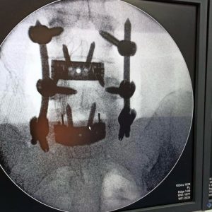 Imagem do WhatsApp de 2025-03-29 à(s) 12.52.35_060e295a Imagem do WhatsApp de 2025-03-29 à(s) 12.52.35_060e295a